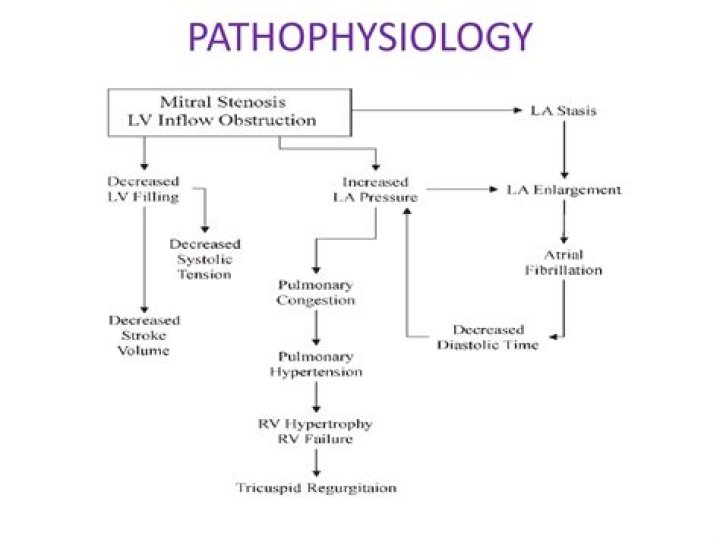What is the pathophysiology of mitral valve disease?