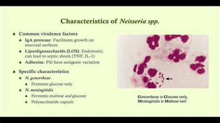 What is the shape of Neisseria sicca?