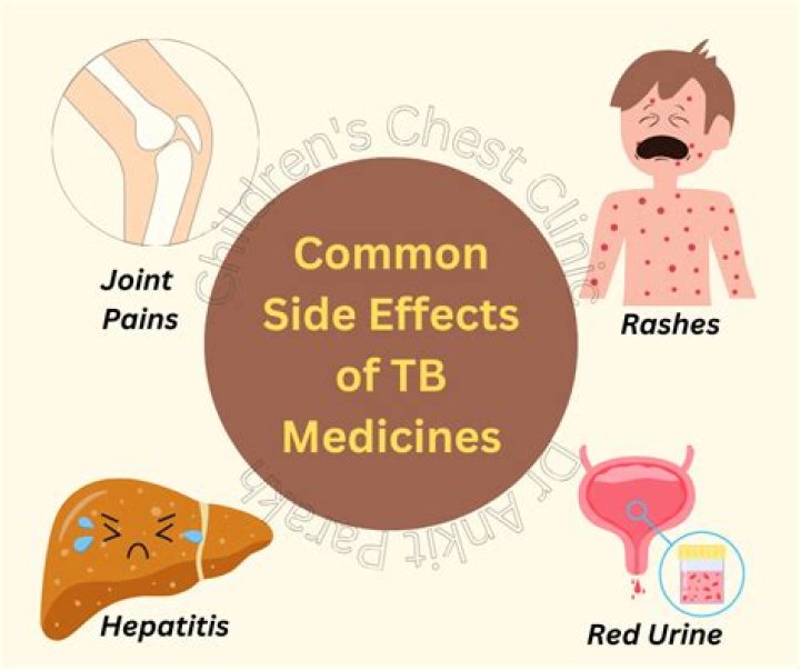 What is the side effects of taking the TB test?