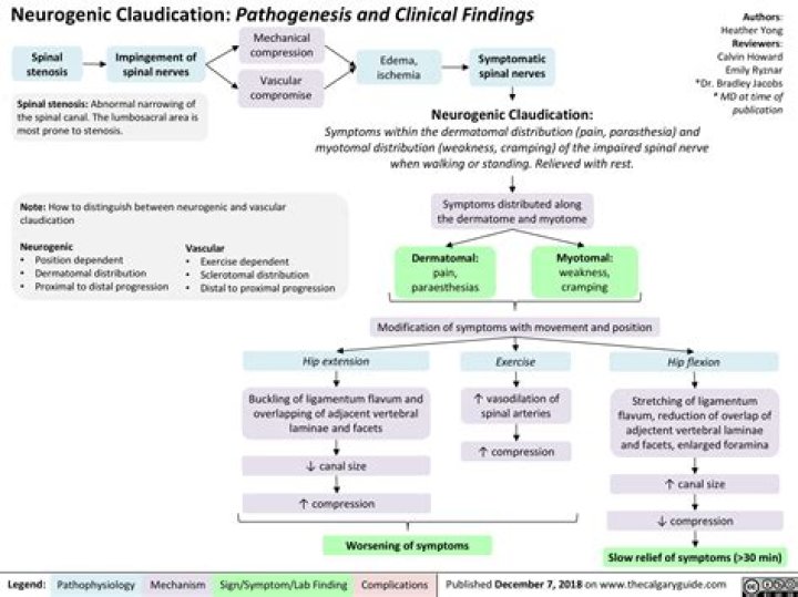What is the treatment for neurogenic claudication?