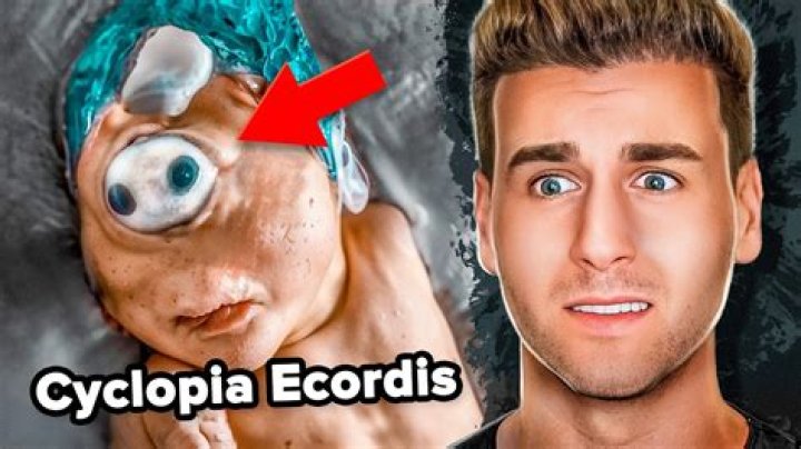 What is the weirdest genetic mutation?