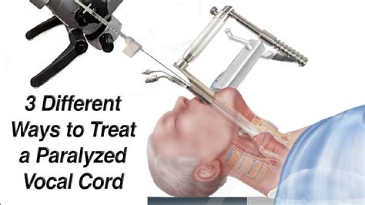 What is vocal cord therapy?