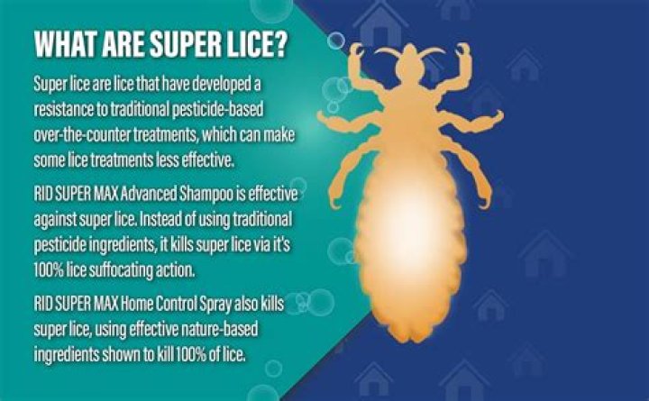 What kills super lice eggs?