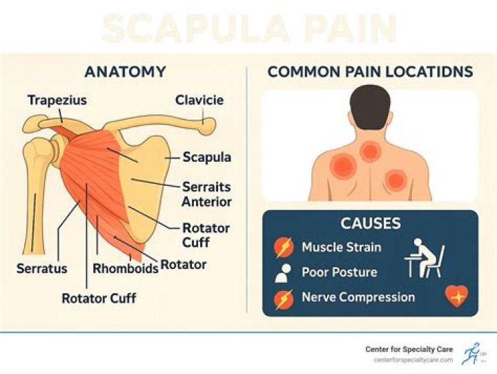 What muscle causes winging of the scapula?