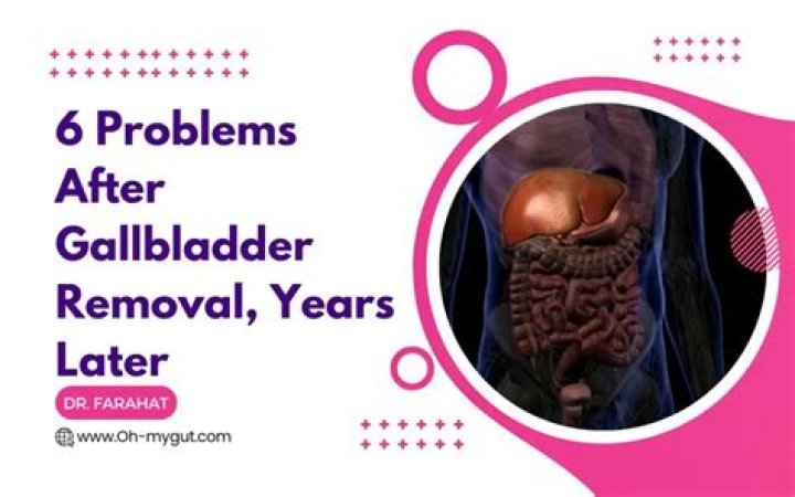 What problems can occur years after gallbladder removal?