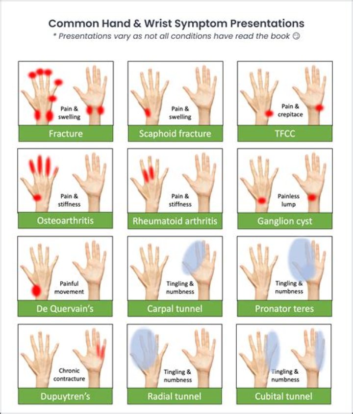 What should you do when your wrist hurts for no reason?