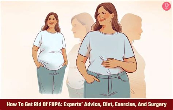 What surgery removes FUPA?