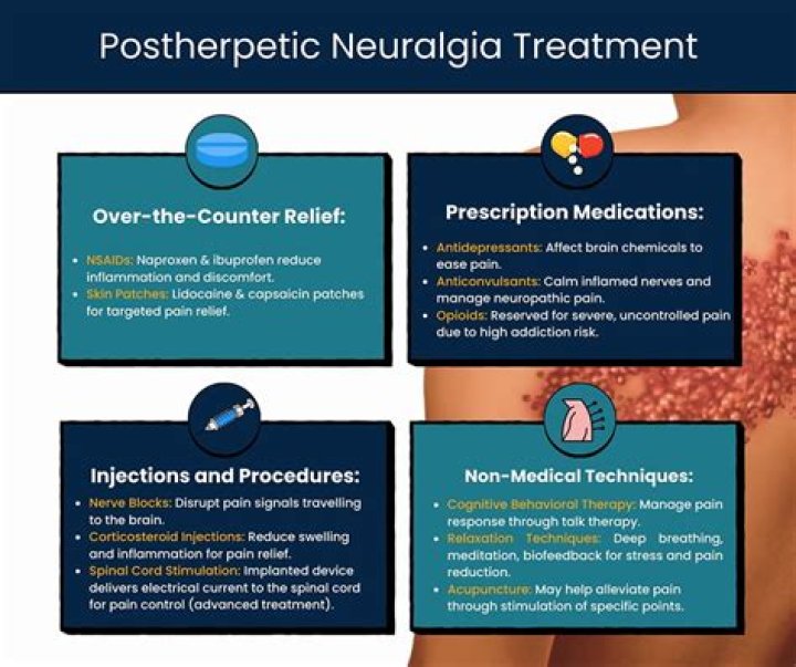 What topical medication is used for post herpetic neuralgia?