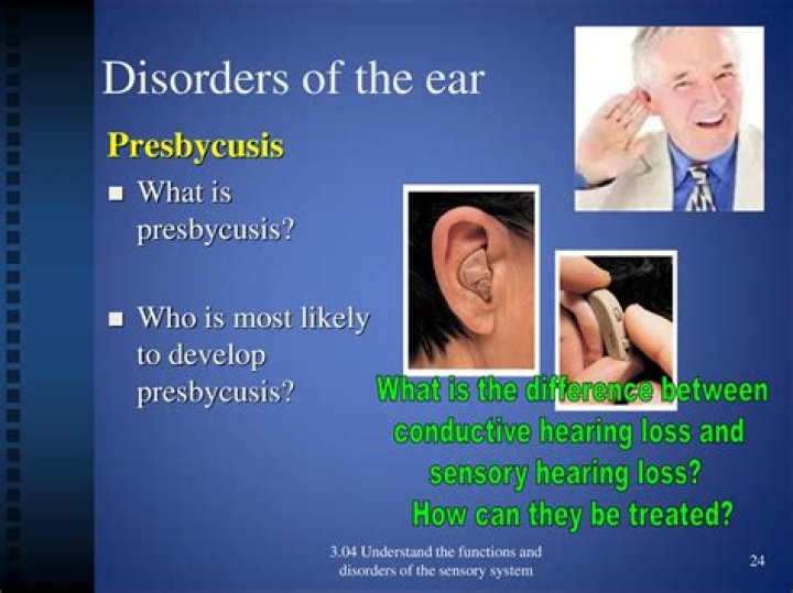 What type of hearing loss is presbycusis?