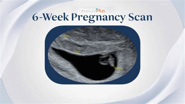 What will I see at 6 Week 4 day ultrasound?