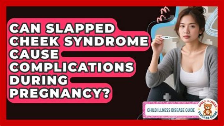 When is slap cheek a risk in pregnancy?