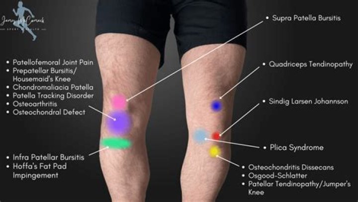 When should I worry about knee pain after a fall?