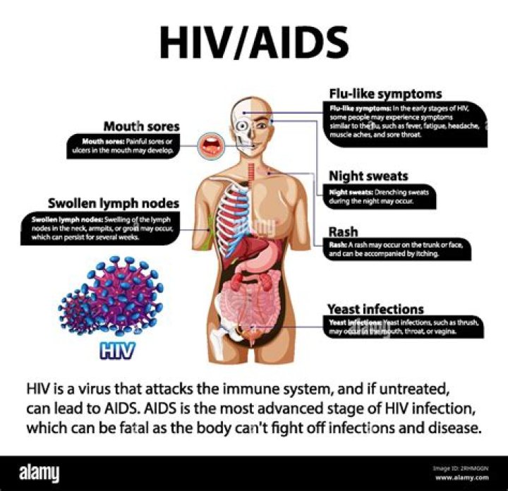 Where is the AIDS virus likely to be found?