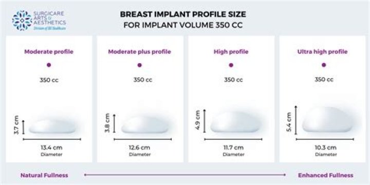 Where is the best country to get breast implants?