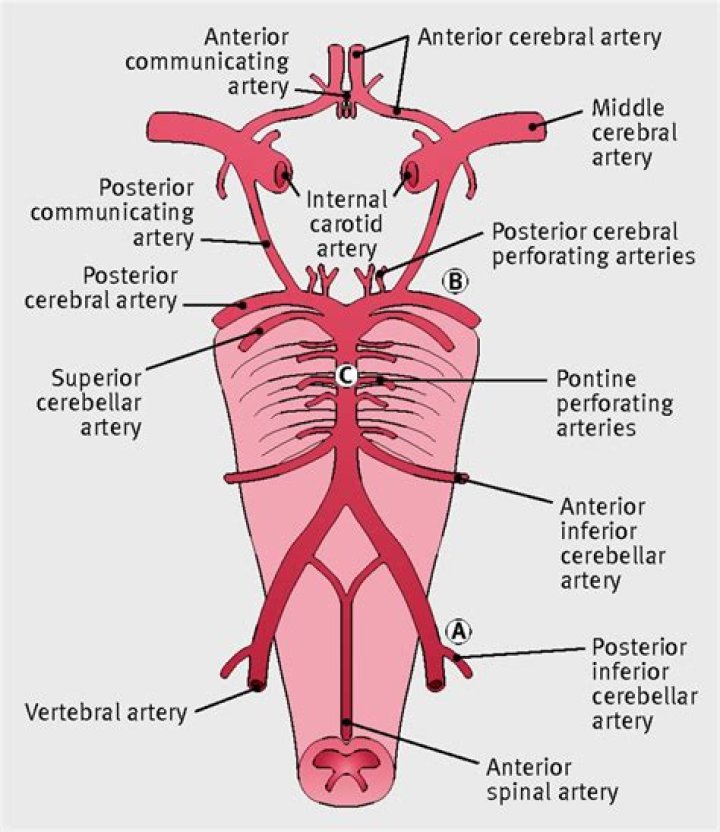 Which artery is blocked in a posterior MI?