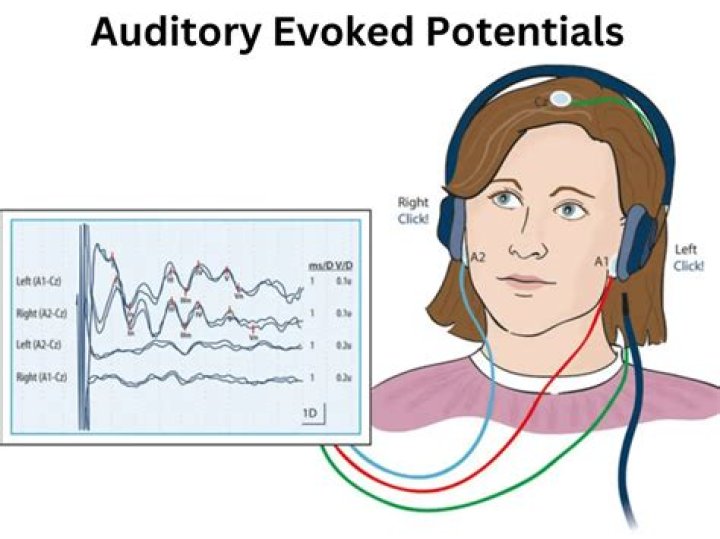 Which is the earliest auditory evoked potential based on latency?