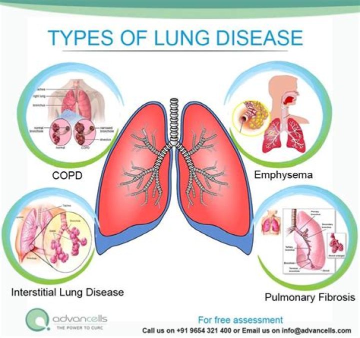 Which type of pollution causes lungs infection?