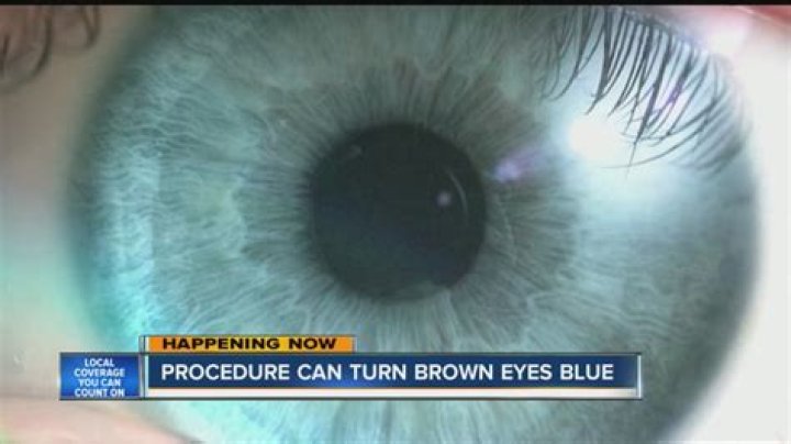 Why are my brown eyes turning blue?