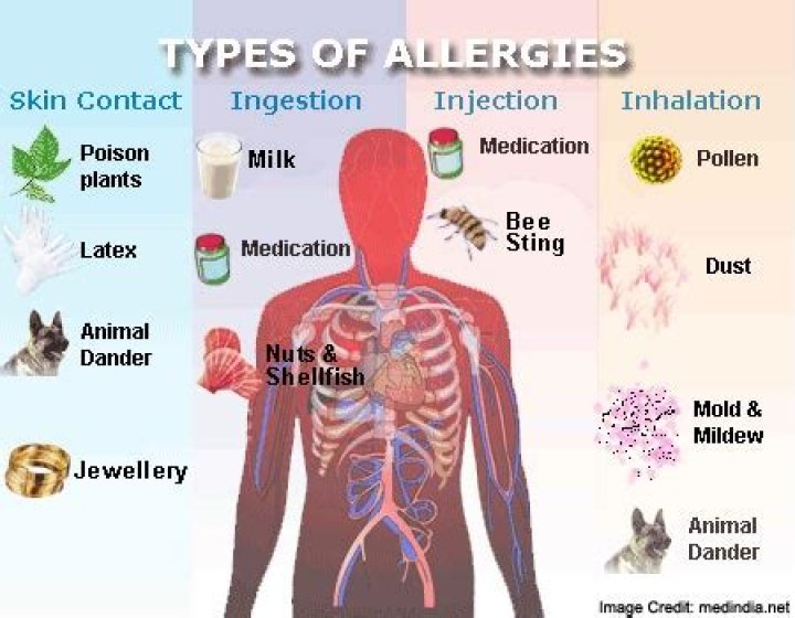 Why are some allergies life-threatening?