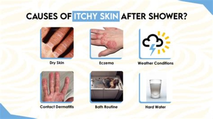 Why can I scratch my skin off in the shower?