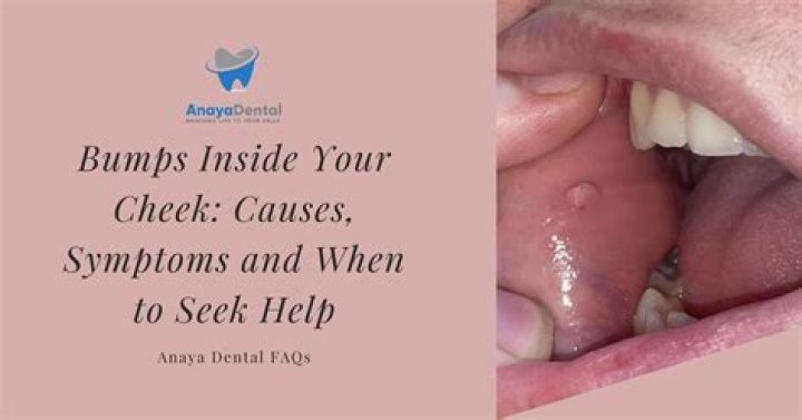 Why do I have a line on the inside of my cheek?