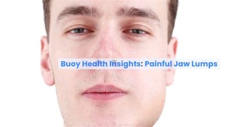 Why do I have a small lump under my jaw?