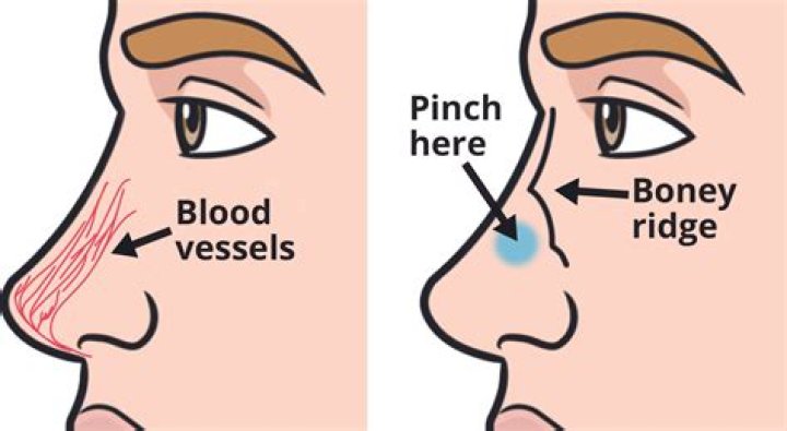 Why do Warheads make my mouth bleed?