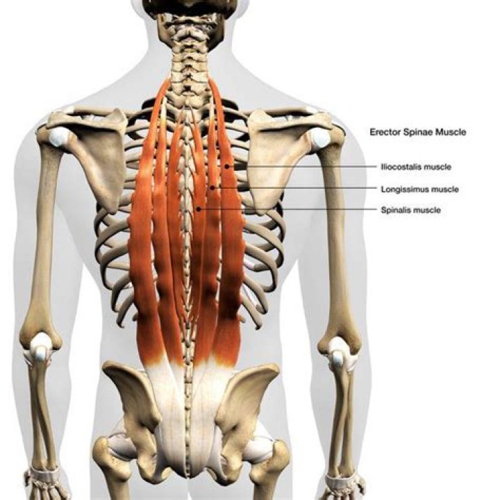 Why does my longissimus hurt?
