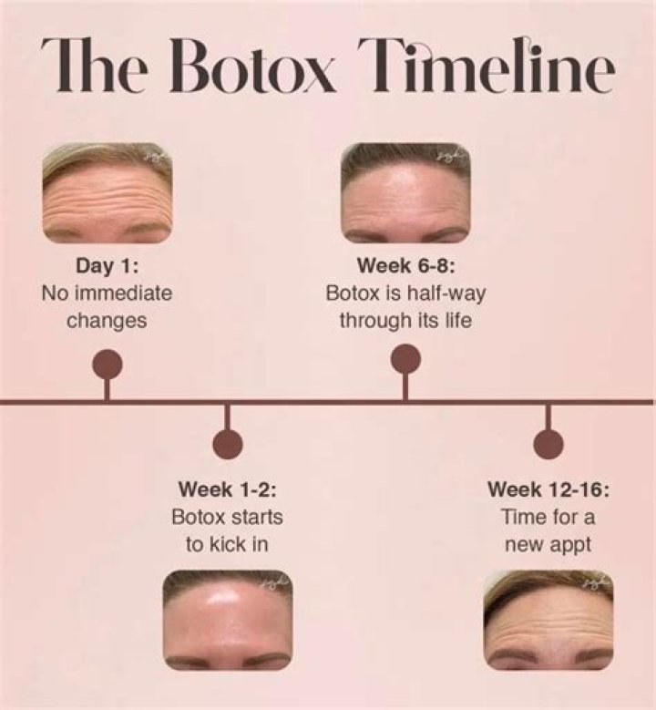 Why has my Botox only lasted a month?