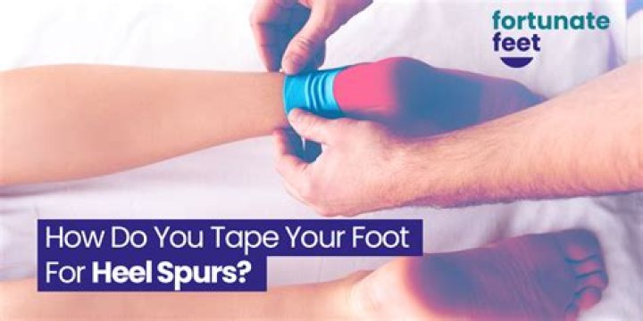 Will taping help heel spurs?